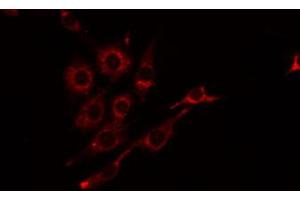 Image no. 3 for anti-Bone Marrow Stromal Cell Antigen 1 (BST1) antibody (ABIN6257787)