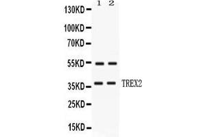 Image no. 1 for anti-three Prime Repair Exonuclease 2 (Trex2) (AA 69-279) antibody (ABIN4886755)