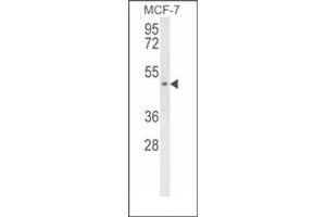 Image no. 1 for anti-Stearoyl-CoA Desaturase 5 (SCD5) (AA 146-175), (Middle Region) antibody (ABIN954682)
