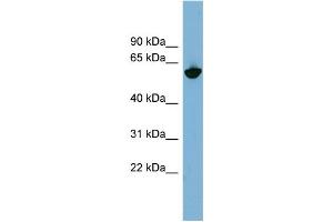 Image no. 1 for anti-Osteoactivin (GPNMB) (N-Term) antibody (ABIN2781895)