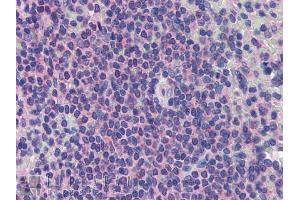 Image no. 1 for anti-Promyelocytic Leukemia (PML) (C-Term) antibody (ABIN927422)
