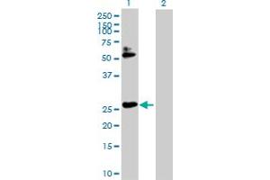 Image no. 1 for anti-Homeobox B7 (HOXB7) (AA 1-217) antibody (ABIN516632)