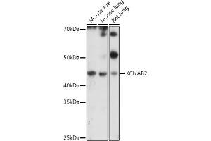 KCNAB2 antibody  (AA 1-40)