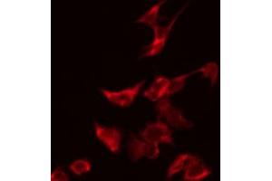 Image no. 1 for anti-Tumor Suppressor Candidate 2 (TUSC2) antibody (ABIN6257655)
