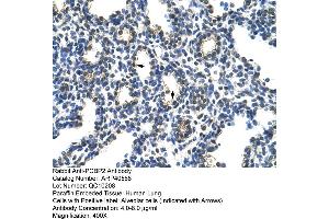 Image no. 2 for anti-Poly(rC) Binding Protein 2 (PCBP2) (Middle Region) antibody (ABIN2778923)