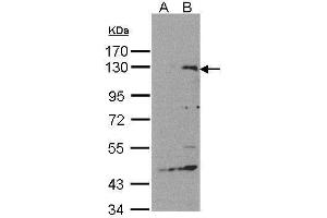 Image no. 4 for anti-Signal-Induced Proliferation-Associated 1 (SIPA1) (C-Term) antibody (ABIN2855951)