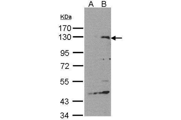 SIPA1 抗体  (C-Term)