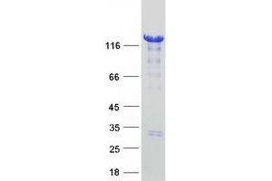 Image no. 1 for Histone Deacetylase 4 (HDAC4) protein (Myc-DYKDDDDK Tag) (ABIN2722509)