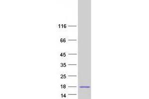 Image no. 1 for Sperm Acrosome Associated Protein 3 (SPACA3) protein (Myc-DYKDDDDK Tag) (ABIN2732484)