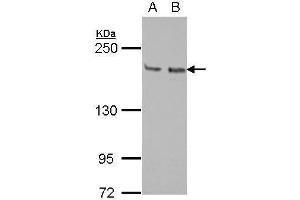WB Image Sample (30 ug of whole cell lysate) A: Jurkat B: Raji 5% SDS PAGE antibody diluted at 1:1000