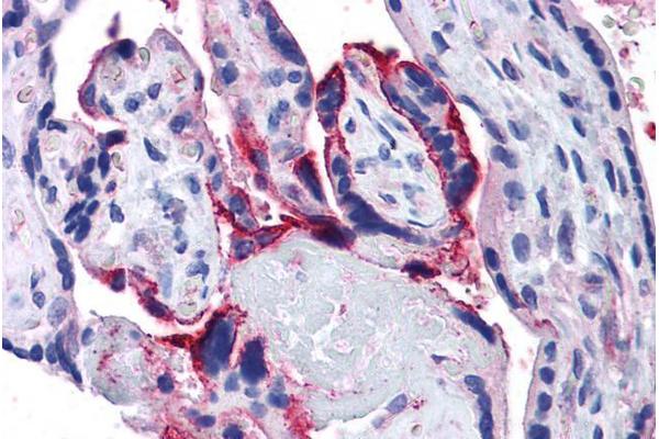 APH1A anticorps  (Internal Region)