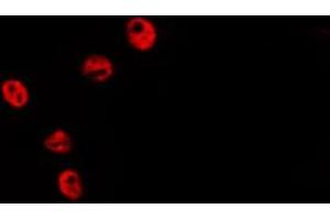 anti-Histone Cluster 1, H2bh (HIST1H2BH) (N-Term) antibody