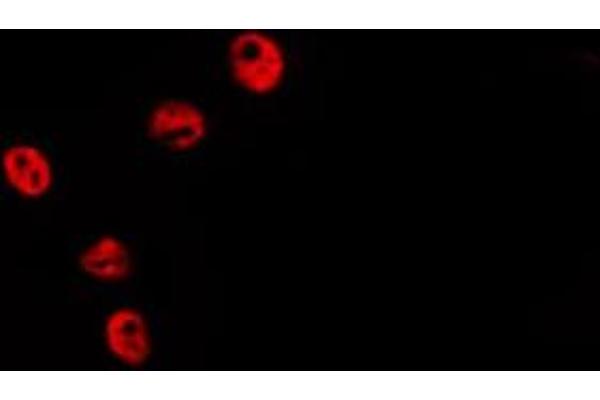 anti-Histone Cluster 1, H2bh (HIST1H2BH) (N-Term) antibody
