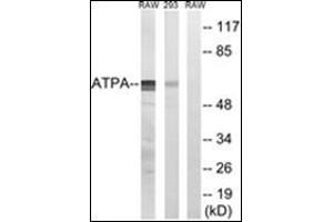 Image no. 2 for anti-Mitochondrially Encoded ATP Synthase 6 (MT-ATP6) (Subunit alpha) antibody (ABIN784208)