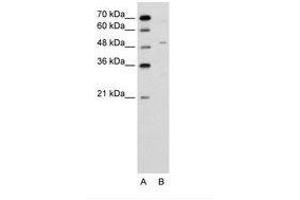 Image no. 1 for anti-Zinc Finger Protein 19 (ZNF19) (AA 51-100) antibody (ABIN6736634)