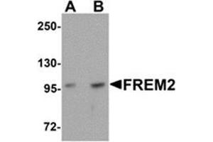 Image no. 2 for anti-Fras1 Related Extracellular Matrix Protein 2 (FREM2) (Center) antibody (ABIN783636)