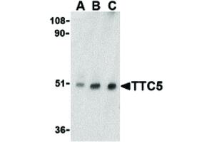 Image no. 1 for anti-Tetratricopeptide Repeat Domain 5 (TTC5) (C-Term) antibody (ABIN6655771)