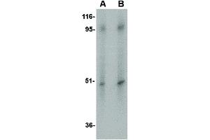 Image no. 1 for anti-Solute Carrier Family 39 (Zinc Transporter), Member 10 (SLC39A10) (Internal Region) antibody (ABIN6656537)