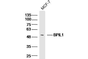 Image no. 2 for anti-BPI Fold Containing Family B, Member 2 (BPIFB2) antibody (ABIN1388021)