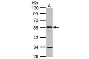 Image no. 2 for anti-Purinergic Receptor P2X, Ligand Gated Ion Channel 2 (P2RX2) (AA 8-302) antibody (ABIN1499950)