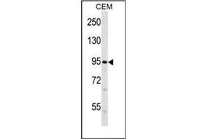 Image no. 1 for anti-Family with Sequence Similarity 38, Member B (FAM38B) (AA 366-396), (C-Term) antibody (ABIN952226)