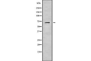 Image no. 1 for anti-Acyl-CoA Dehydrogenase Family, Member 9 (ACAD9) (Internal Region) antibody (ABIN6259713)