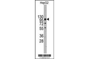 Image no. 3 for anti-Cadherin 4 (CDH4) (AA 182-211), (N-Term) antibody (ABIN356865)