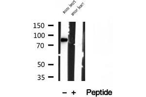 anti-YME1-Like 1 (YME1L1) (C-Term) antibody
