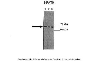 Image no. 2 for anti-Nuclear Factor of Activated T-Cells 5, Tonicity-Responsive (NFAT5) (Middle Region) antibody (ABIN2780105)