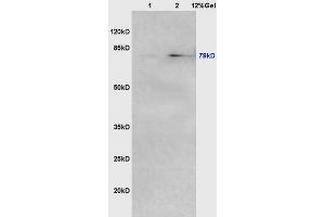 Image no. 1 for anti-Angiogenic Factor with G Patch and FHA Domains 1 (AGGF1) (AA 492-537) antibody (ABIN722380)