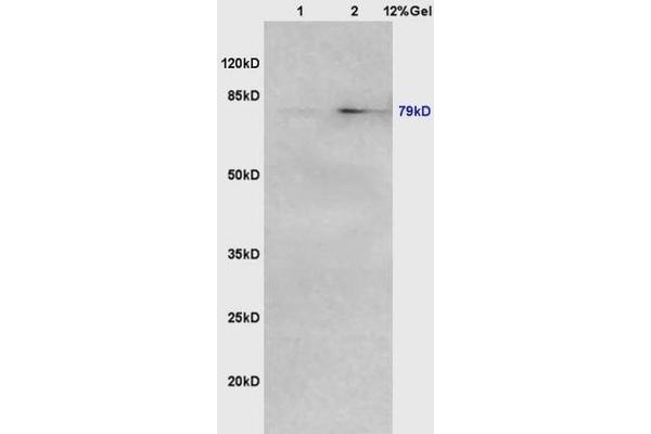 AGGF1 anticorps  (AA 461-560)