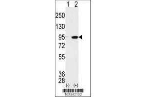 Image no. 1 for anti-Male Germ Cell-Associated Kinase (MAK) (AA 578-608), (C-Term) antibody (ABIN391782)