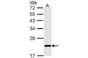 Image no. 2 for anti-BH3 Interacting Domain Death Agonist (BID) (Center) antibody (ABIN2855009)