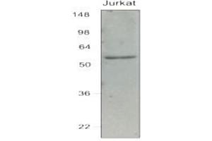 Image no. 1 for anti-Interferon Regulatory Factor 7 (IRF7) (AA 1-150), (N-Term) antibody (ABIN263914)