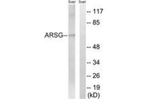 Image no. 2 for anti-Arylsulfatase G (ARSG) (AA 251-300) antibody (ABIN1534654)