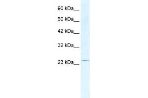 Image no. 1 for anti-SRY (Sex Determining Region Y)-Box 14 (SOX14) (Middle Region) antibody (ABIN2776412)