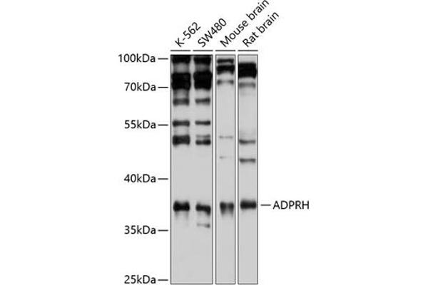 ADPRH Antikörper  (AA 180-270)