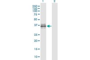 Image no. 2 for anti-Insulin-Like Growth Factor Binding Protein 3 (IGFBP3) (AA 182-291) antibody (ABIN2565626)