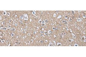 Immunohistochemistry of paraffin-embedded Human brain tissue using WIF1 Polyclonal Antibody at dilution of 1:100(x200)