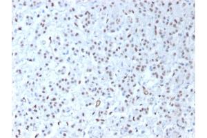 Image no. 2 for anti-Wilms Tumor 1 (WT1) antibody (ABIN6940905)