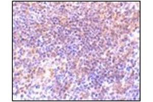 Image no. 1 for anti-P21-Activated Kinase 2 (PAK2) (N-Term) antibody (ABIN500441)