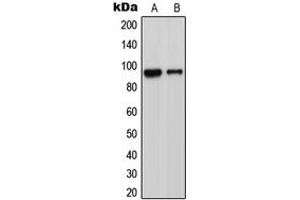 Image no. 1 for anti-ADAM Metallopeptidase Domain 23 (Adam23) (C-Term) antibody (ABIN2704445)