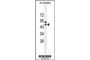 Image no. 1 for anti-Sprouty-Related, EVH1 Domain Containing 3 (SPRED3) (AA 31-59), (N-Term) antibody (ABIN654220)