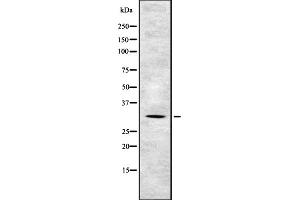 Image no. 1 for anti-Tumor Suppressing Subtransferable Candidate 4 (TSSC4) (C-Term) antibody (ABIN6259499)