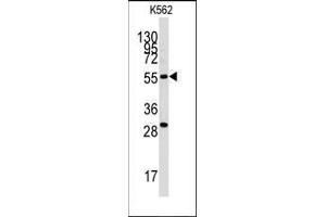 Image no. 2 for anti-Chloride Intracellular Channel 5 (CLIC5) antibody (ABIN359754)