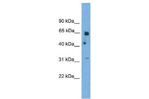 Image no. 1 for anti-Polynucleotide Kinase 3'-Phosphatase (PNKP) (N-Term) antibody (ABIN633050)