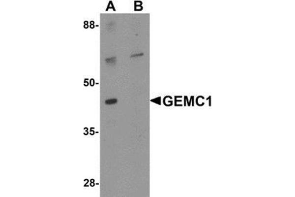 GEMC1 antibody  (Center)