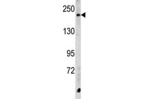 Image no. 1 for anti-Carboxypeptidase D (CPD) (AA 1019-1048) antibody (ABIN3028532)