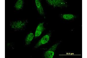 Image no. 3 for anti-Zinc Finger, HIT-Type Containing 3 (ZNHIT3) (AA 1-155) antibody (ABIN522780)