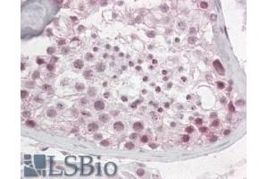 Image no. 1 for anti-Pescadillo Ribosomal Biogenesis Factor 1 (PES1) (N-Term) antibody (ABIN185017)